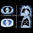 2021 09 13 18 10 0711 Lung Ct Images 400