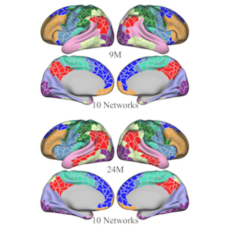 Functional MRI reveals how infants' brains develop | AuntMinnie