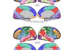 2023 08 02 20 34 2542 2023 08 01 E Life Wang Brain Mri 400