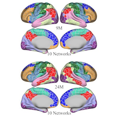 2023 08 02 20 34 2542 2023 08 01 E Life Wang Brain Mri 400