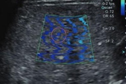 2023 08 02 21 35 9451 2023 08 02 Ajr Swe Liver 20230802213331
