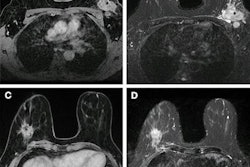 2023 08 02 22 24 4934 2023 08 01 Radiology Mri Breast Radiomics 20230802220527