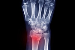2023 08 08 16 58 4346 Distal Radius Fracture 400