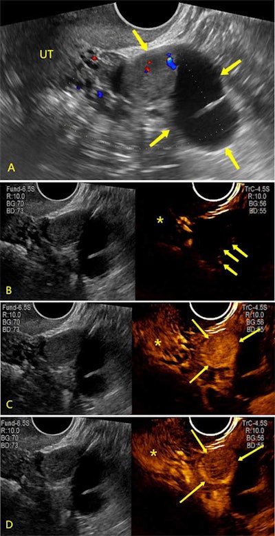 2023 08 08 21 00 7893 2023 08 08 Radiology Ceus Orads