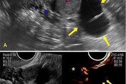 2023 08 08 21 00 7893 2023 08 08 Radiology Ceus Orads 20230808210319