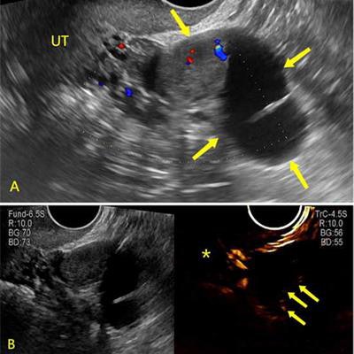 2023 08 08 21 00 7893 2023 08 08 Radiology Ceus Orads 20230808210319