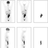 2023 08 15 20 59 1662 2023 08 15 Ai Lymphoma 20230815200315