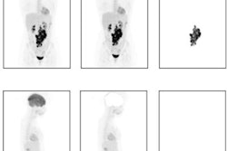 2023 08 15 20 59 1662 2023 08 15 Ai Lymphoma 20230815200315