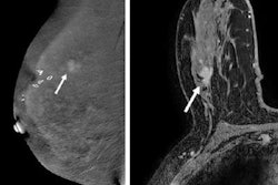 2023 08 15 22 32 4230 2023 08 15 Radiology Cem Mri 20230815223719
