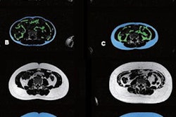 2023 08 16 21 35 5159 2023 08 16 Mri Childhood Obesity Figure3 Abcdef 20230816215731