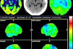 2023 08 17 18 10 1951 2023 08 17 Pet Parkinsonism 20230817182708