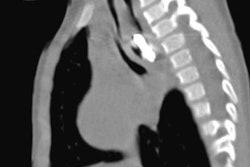 2023 08 21 22 48 3162 2023 08 22 Battery X Ray 20230821221732