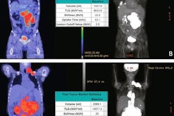 2023 08 22 22 21 7545 2023 08 23 Pet Lymphoma 20230822221636