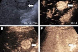 2023 08 29 20 27 9331 2023 08 29 Radiology Ceus 20230829205737