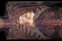 2023 08 30 20 10 0099 2023 08 30 Anatomage 3 D 20230830200822