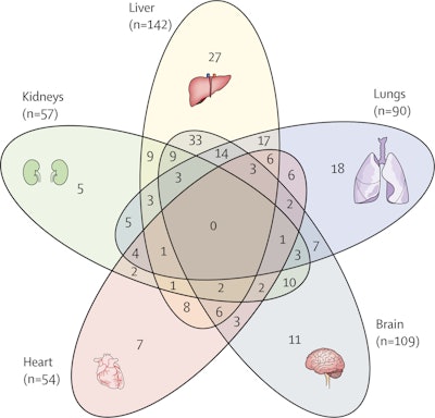Diagram shows overlap of organ abnormalities on MRI after hospitalization for COVID-19 and the most common triad of organ abnormalities. Numbers in brackets represent the absolute number of people with relevant organ abnormalities on MRI. Figures courtesy of Lancet Respiratory Medicine.