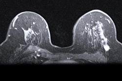 Mri Breast 400