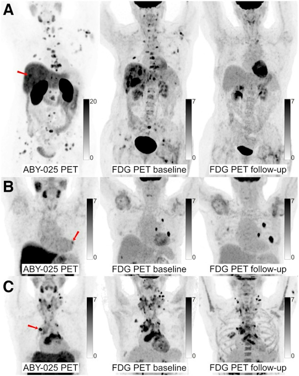 Advancing Whole-body Dynamic PET Imaging for Understanding Disease  Metabolism
