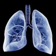 2021 01 21 19 03 5869 Lung Illustration Blue 400