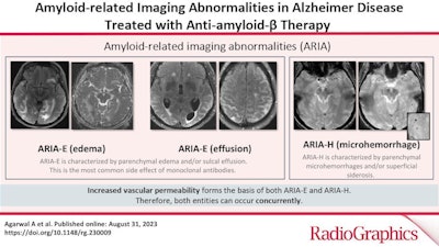 A graphical abstract.