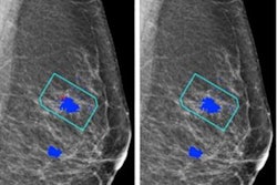 2023 09 01 20 08 8874 2023 09 05 Radiology Ai Mammo 20230901202404