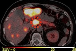 2023 09 05 17 32 1374 2023 09 05 Pet Ct Midgut Ne Ts 400