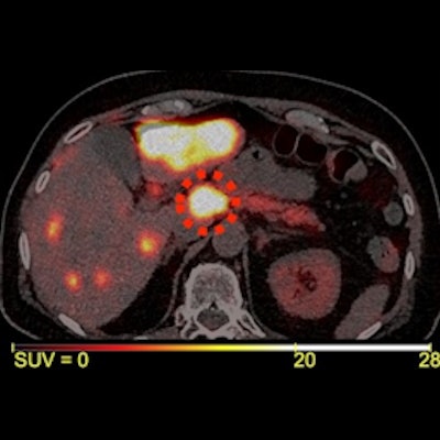 Advancing Whole-body Dynamic PET Imaging for Understanding Disease  Metabolism