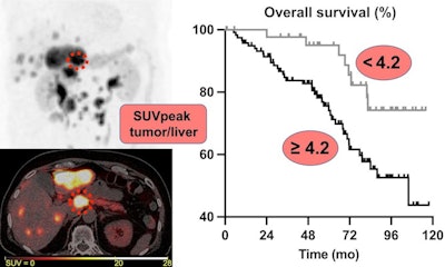 A visual abstract. Image courtesy of the Journal of Nuclear Medicine.