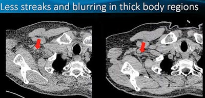 All images courtesy of Cynthia McCollough, PhD, and Mayo Clinic.
