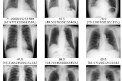 2023 09 11 19 21 6210 2023 09 06 X Ray Age 20230911195735