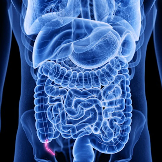 Deep learning helps categorize acute appendicitis on pelvic CT | AuntMinnie