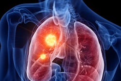 Lung Cancer Hotspot 400