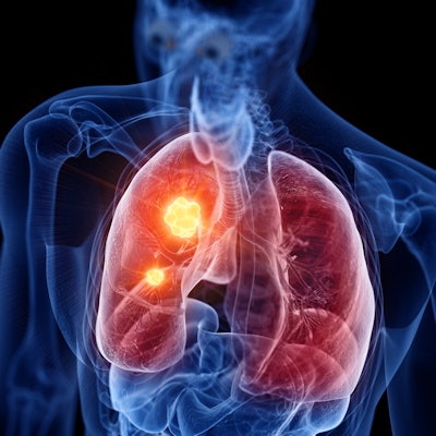 Lung Cancer Hotspot 400