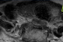 Incidental imaging finding. Image courtesy of Hailey Choi, MD, of the University of California, San Francisco.