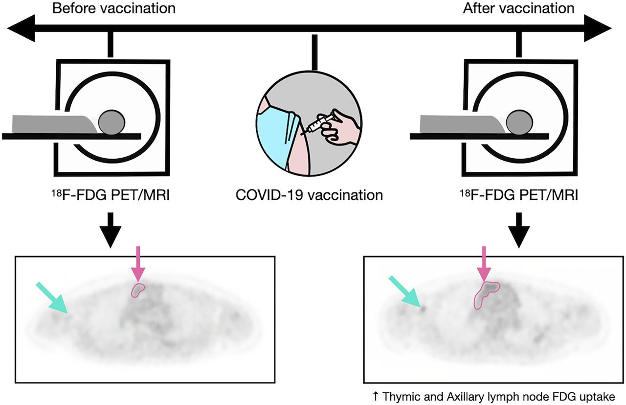 A graphic abstract describing the study. Image courtesy of the Journal of Nuclear Medicine.