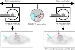 A graphic abstract describing the study. Image courtesy of the Journal of Nuclear Medicine.