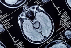 Mri Brain Head Social