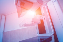 Breast Mammography Scanner 400 (1)