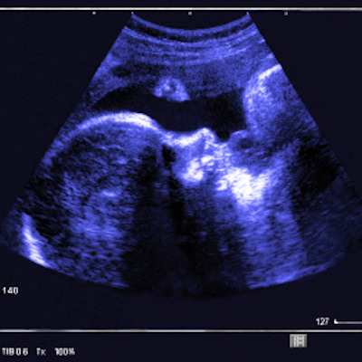 Fetal Ultrasound 400