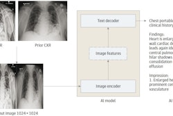 The AI model is an encoder-decoder model trained to generate a text report given a chest x-ray and most recent comparison (anterior-posterior or posterior-anterior view only). The vision encoder weights were initialized from Vision Transformer (ViT) base and the text decoder weights were initialized from Robustly Optimized BERT Pretraining Approach (RoBERTa) base before training for 30 epochs on a data set of 900,000 chest x-rays (CXRs). cp indicates chest pain; sob = shortness of breath. Image courtesy of JAMA Open Network.