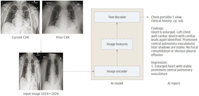 The AI model is an encoder-decoder model trained to generate a text report given a chest x-ray and most recent comparison (anterior-posterior or posterior-anterior view only). The vision encoder weights were initialized from Vision Transformer (ViT) base and the text decoder weights were initialized from Robustly Optimized BERT Pretraining Approach (RoBERTa) base before training for 30 epochs on a data set of 900,000 chest x-rays (CXRs). cp indicates chest pain; sob = shortness of breath. Image courtesy of JAMA Open Network.
