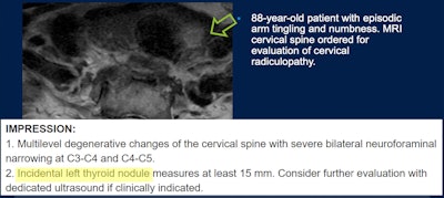 Incidental imaging finding. Image courtesy of Hailey Choi, MD, of the University of California, San Francisco.