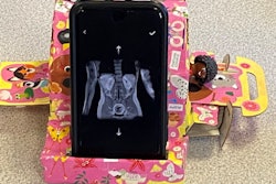 A smartphone is a key component of the playkit devised by the Sheffield team. Photo courtesy of DYR in collaboration with Dubit UK.