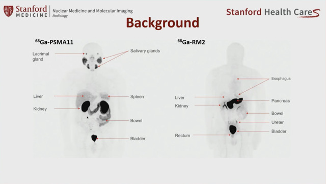 2023 11 27 Prostate Cancer Pet Tracer
