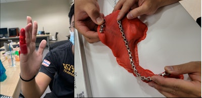 Singapore has emphasized 3D printing of anatomical models. Courtesy of Dr Michael Yam, lead for 3D printing centre in Tan Tock Seng Hospital (TTSH).