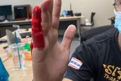 2023 11 28 Singapore Rsna 3 D Printing Image1