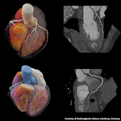 Images generated on Somatom Pro.Pulse. Image courtesy of Siemens.