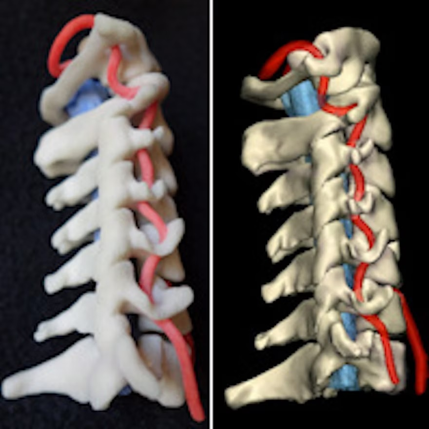 3dspine