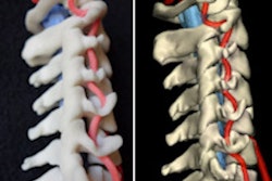 3dspine