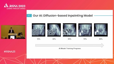 Pouria Rouzrokh, MD, of the the Mayo Clinic in Rochester, MN, discussed a model named THA-Net at RSNA on November 26 in Chicago. Image courtesy of the RSNA.